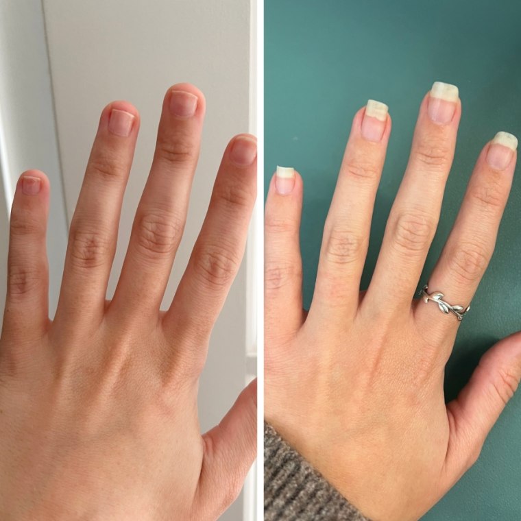 Before image of woman’s hand with short nails and after image of same woman’s hand with longer nails